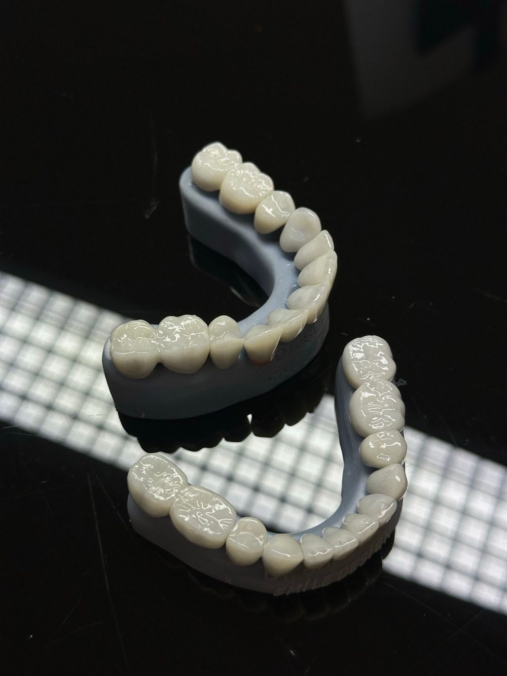 Dental veneers on a dark reflective surface